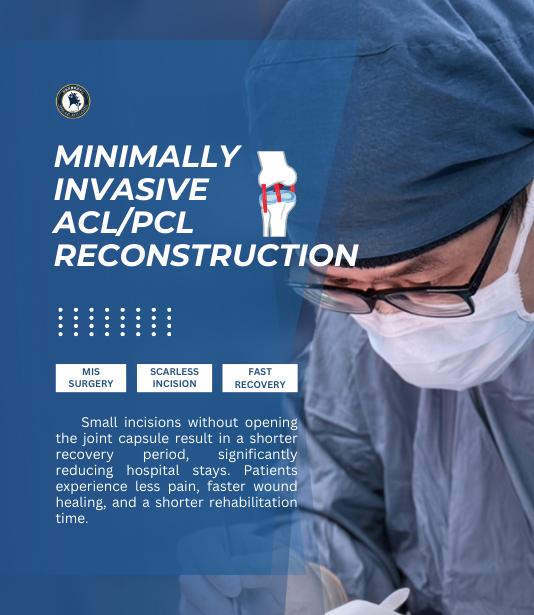 ACL & PCL Reconstruction Surgery | Expert Sports Injury Care in ...