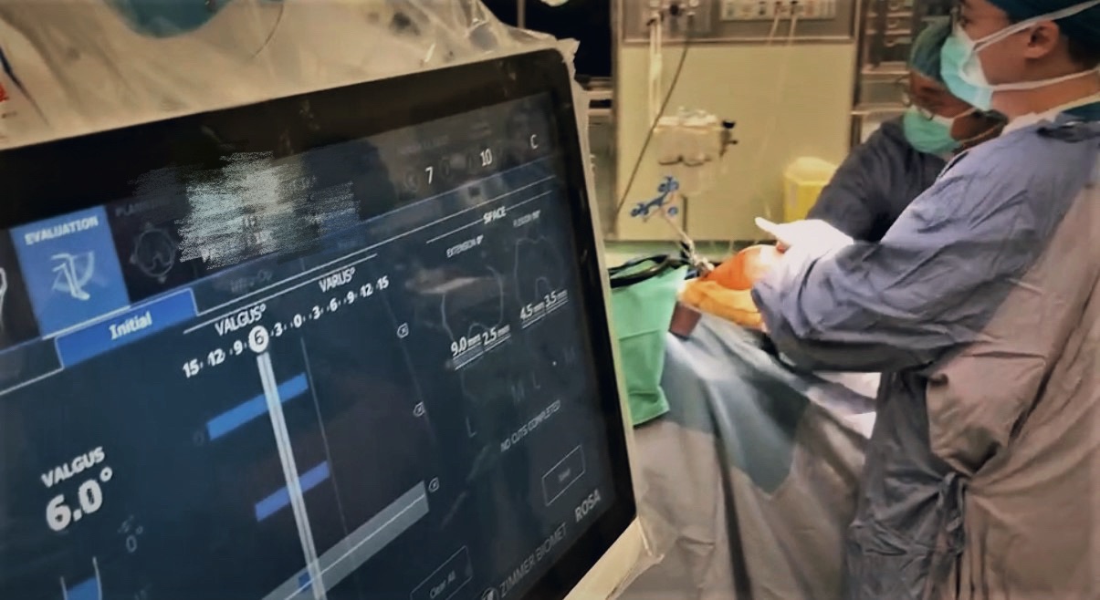 ROSA Knee 3D機器人手臂置換膝關節，術後當天就能下床