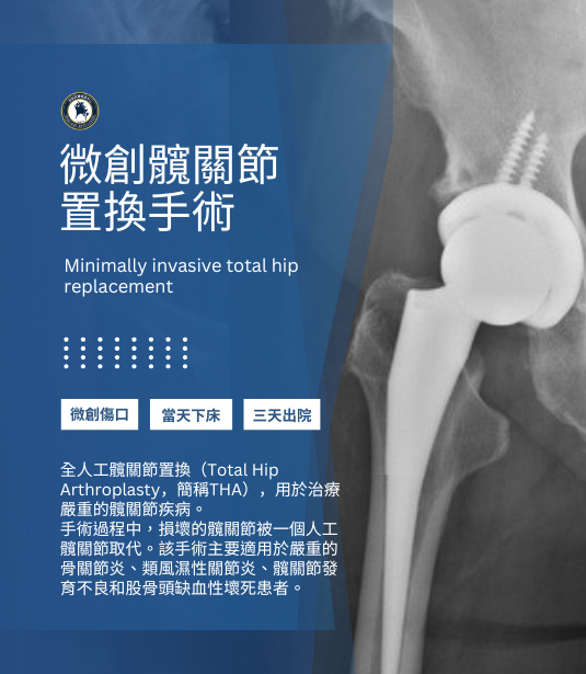 微創人工髖關節置換手術術後當天可下床、三天可出院 微創人工髖關節置換手術術後當天可下床、三天可出院