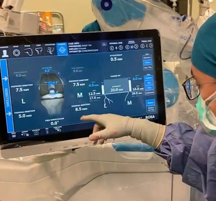 85-Year-Old Woman Avoids Rehabilitation! Safe and Precise Minimally Invasive Knee Replacement with Robotic Arm Four Key Facts to Know Before Undergoing Total Knee Replacement Surgery