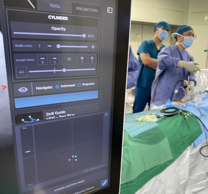 脊椎內視鏡手術最新懶人包：技術演進、臨床應用、椎間盤突出治療