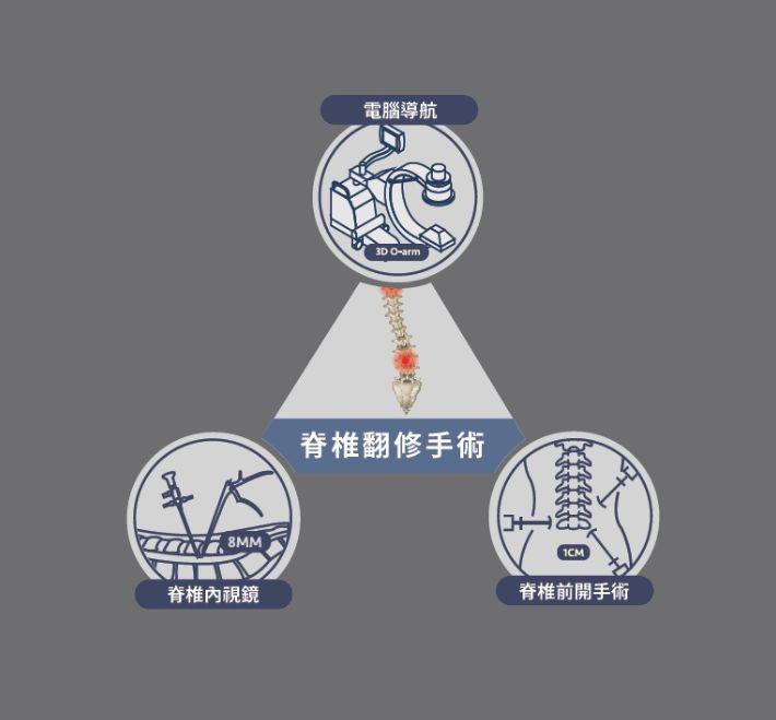 脊椎翻修手術全攻略：當「再次手術」成為必要，如何控制風險？